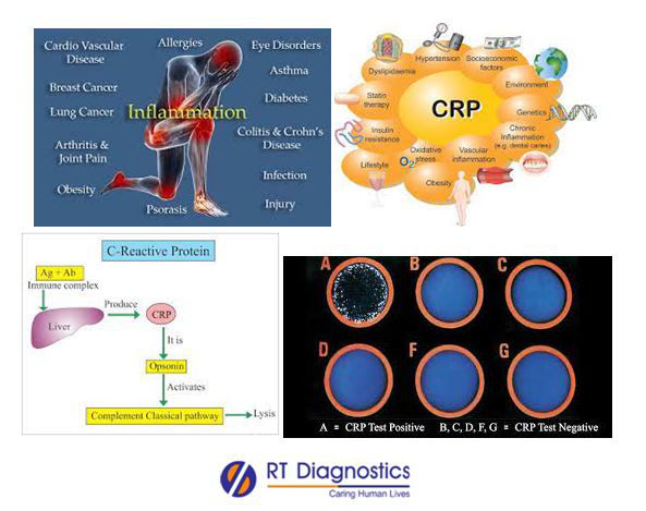 CRP | RT Diagnostics